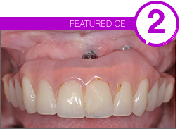CE - Featured Image